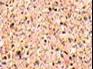 Lumaquela Pink